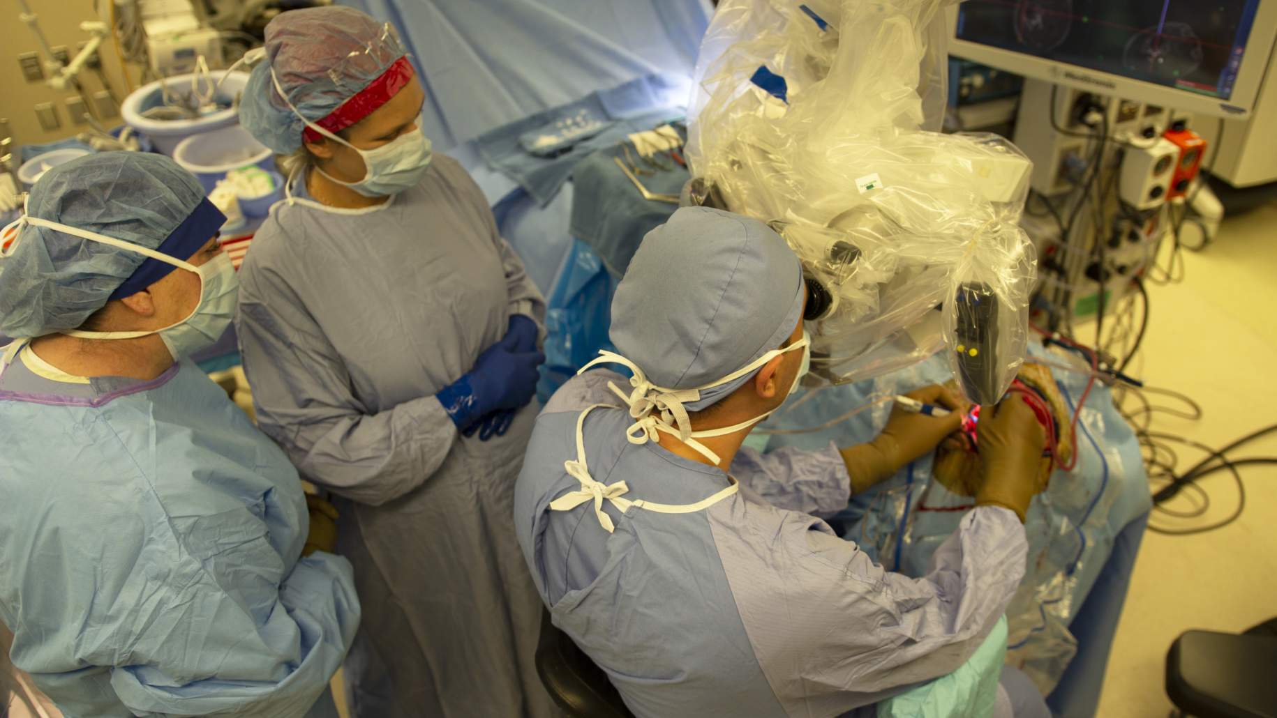 صورة 1: فريق جراحة المخ والأعصاب يعمل على إزالة التشوه الشرياني الوريدي باستخدام المجهر الجراحي.